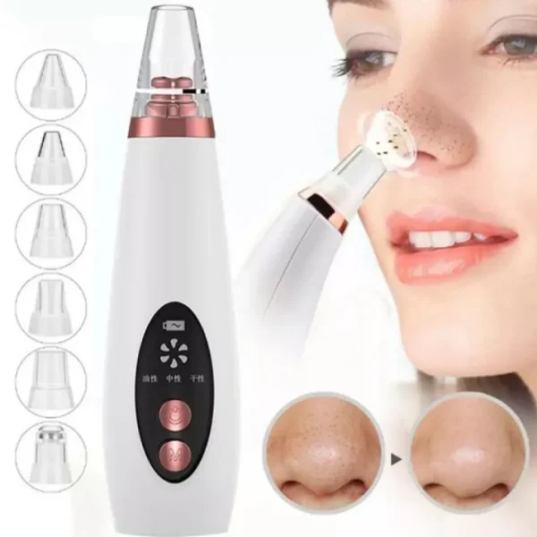 Electric Blackhead Remover | Face Suction Pore Cleaner (5 Levels)